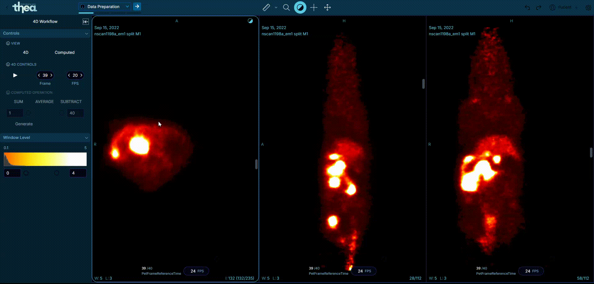 Visor de imágenes DICOM (2D 3D 4D)