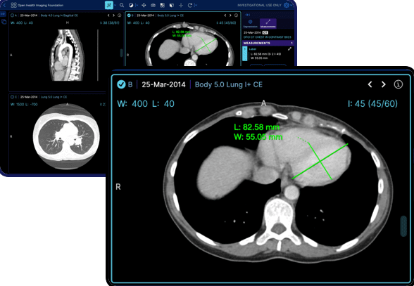 Vea todos los detalles con soporte para fusión de imágenes multimodales, reformateo multiplanar y más