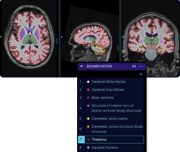 Medición y anotación de imágenes, Utilice una biblioteca robusta de herramientas de anotación y medición fáciles de usar.