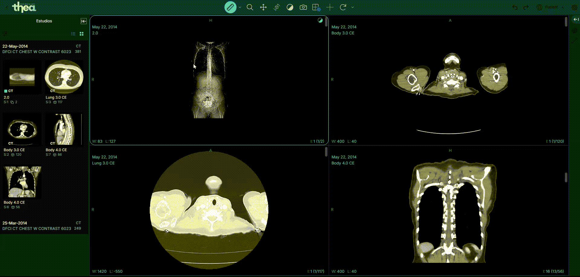 Visor de imágenes DICOM (Medidas)