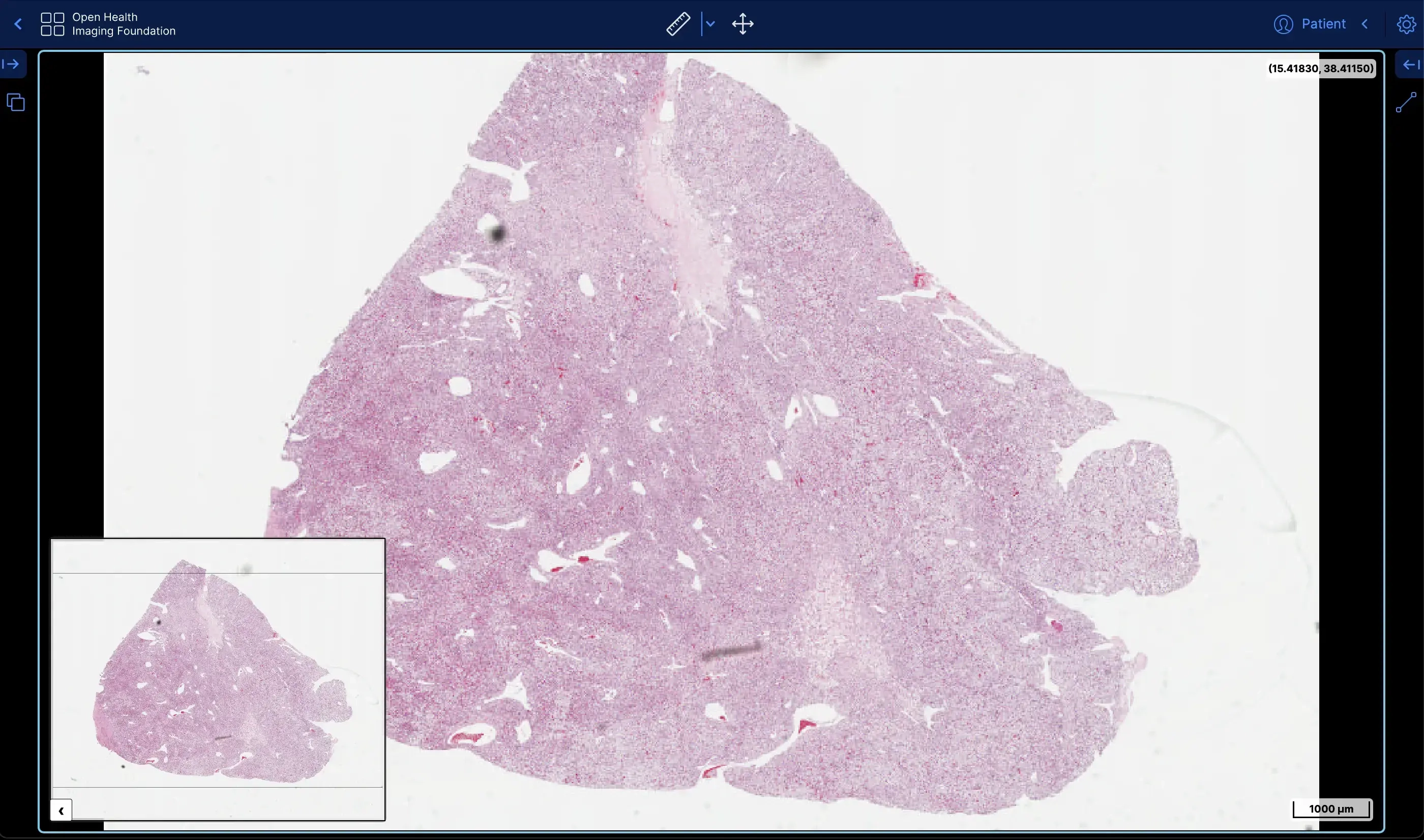 MICROSCOPÍA DIGITAL DE ALTA RESOLUCIÓN
