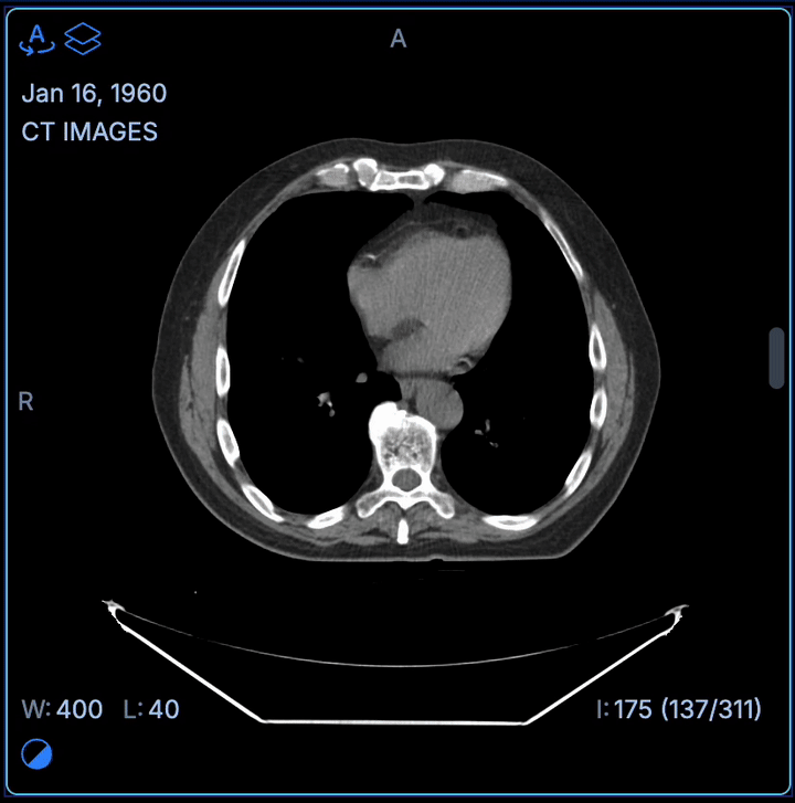 Benefíciese de la experiencia, la colaboración y la innovación de nuestra comunidad de código abierto.