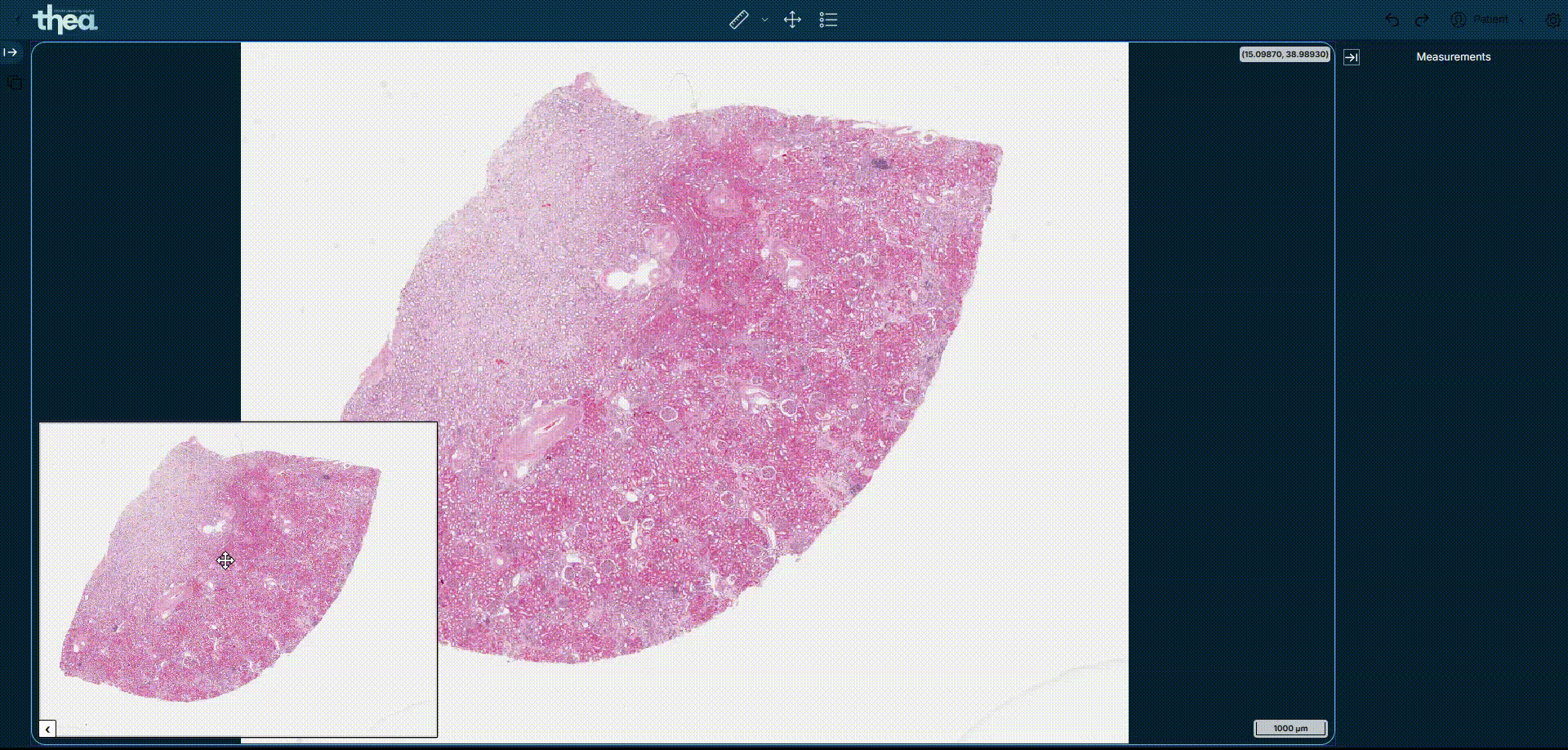 Microscopía de portaobjetos