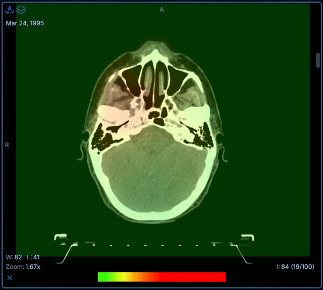 Cuadro de diálogo de ventana gráfica mejorada para fusión de multimodalidad