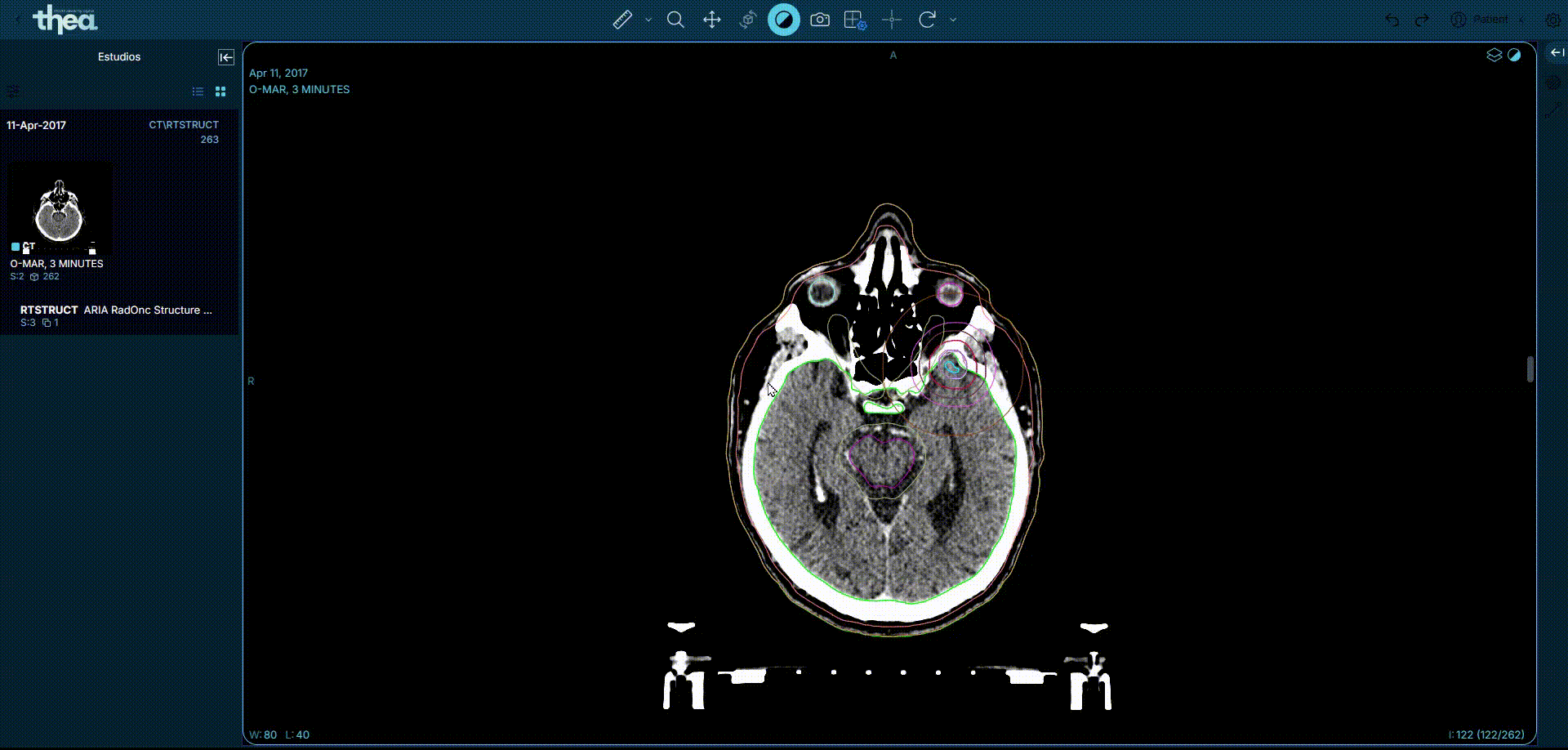 Estructura RT en radioterapia