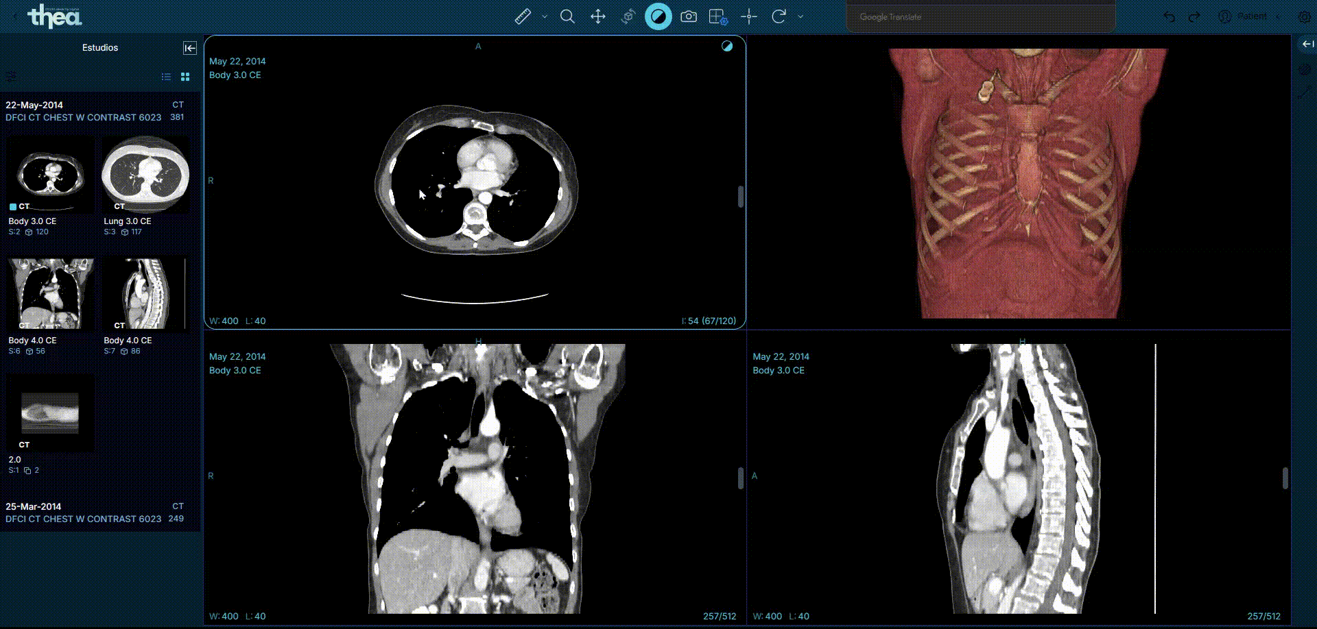 Renderizado de volumen