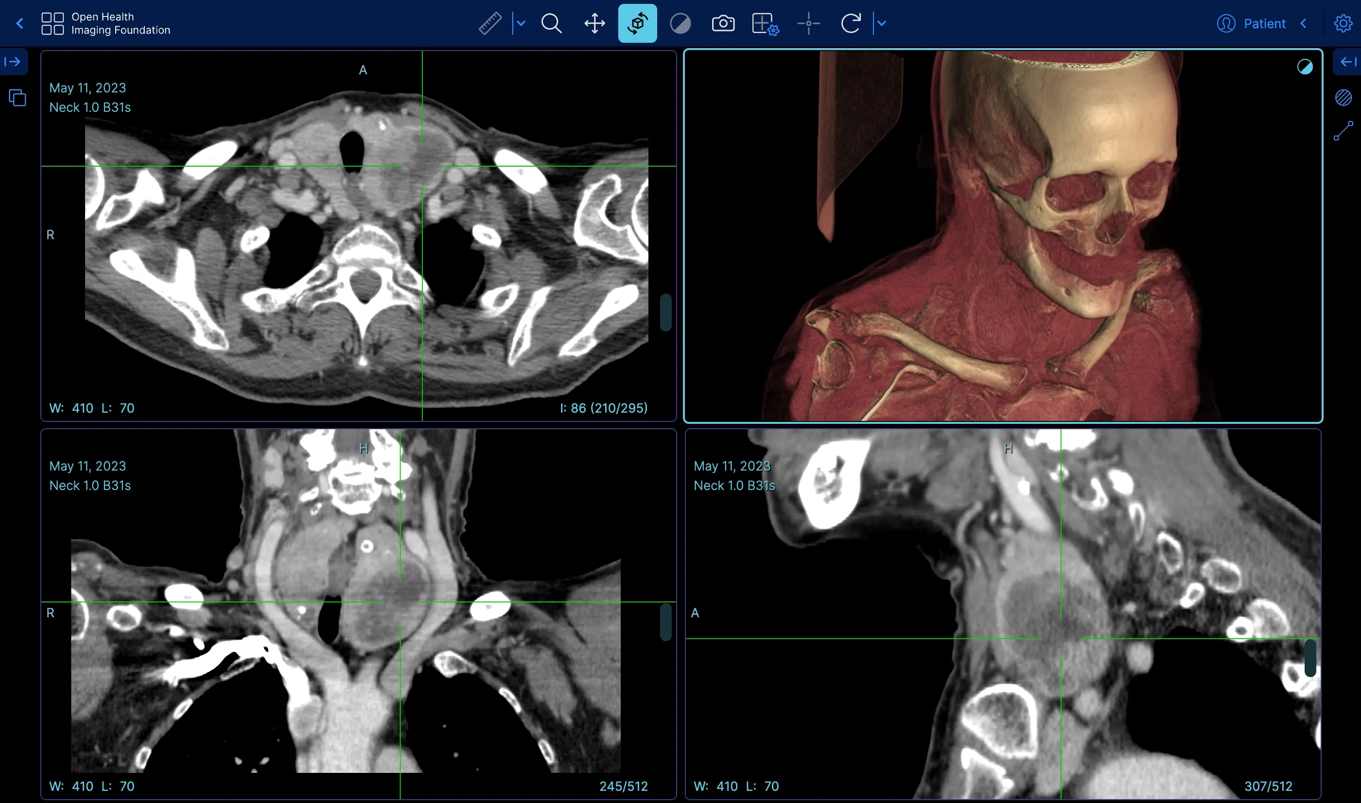 PLATAFORMA ABIERTA Y CONFIGURABLE